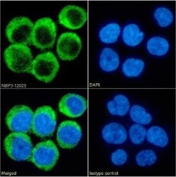 CD40 Ligand/TNFSF5 Rabbit anti-Human, Clone: chi220, Novus Biologicals